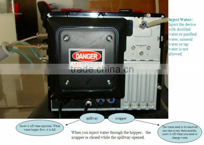 2014 Hottest sale q-switched nd yag laser tattoo removal machine nd yag laser korea