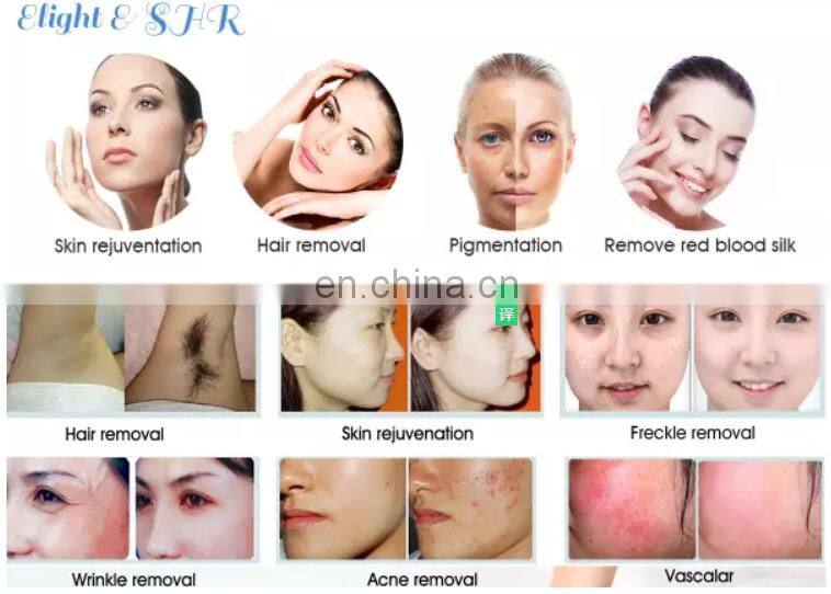 Salon clinic use vertical rf vacuum cavitation slimming machine elight shr nd yag laser multifunction machine