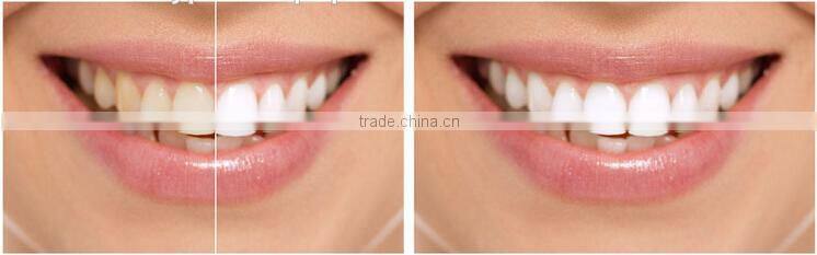 AYJ-J003A laser teeth whitening machine /teeth whitening laser