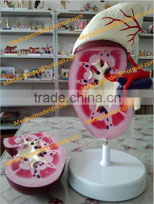 Kidney anatomical model