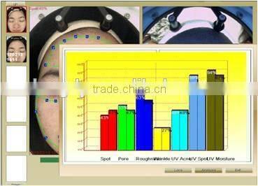 CE Approval 1 years warranty magic mirror facial skin analyzer