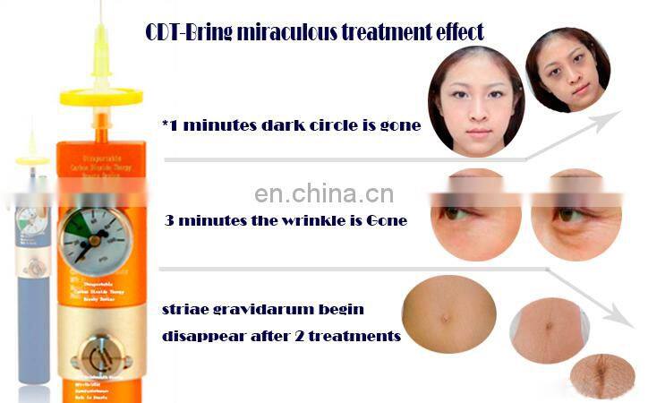 CE approved CDT carboxytherapy beauty machine for C2P injector black eye removal