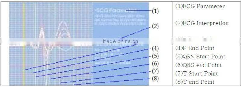 High-Quality Disposable Automatic Measurement Auto Handheld Cheap 3 Channels ECG Machine