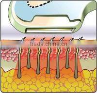 Best hair removal ipl photo epilation ipl and pigmentation home use