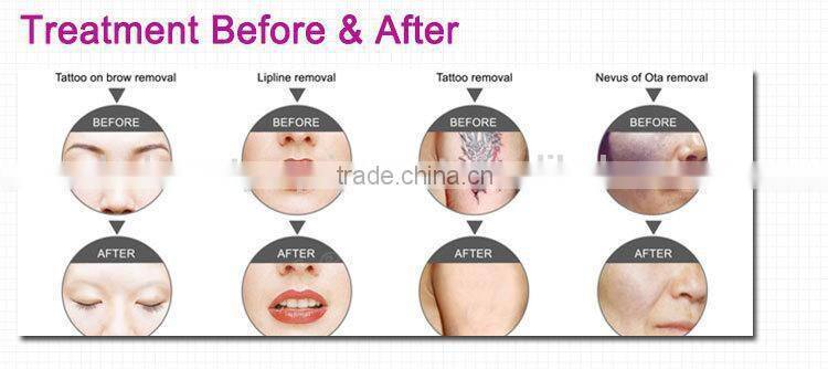 new technology product in china new best tattoo ink