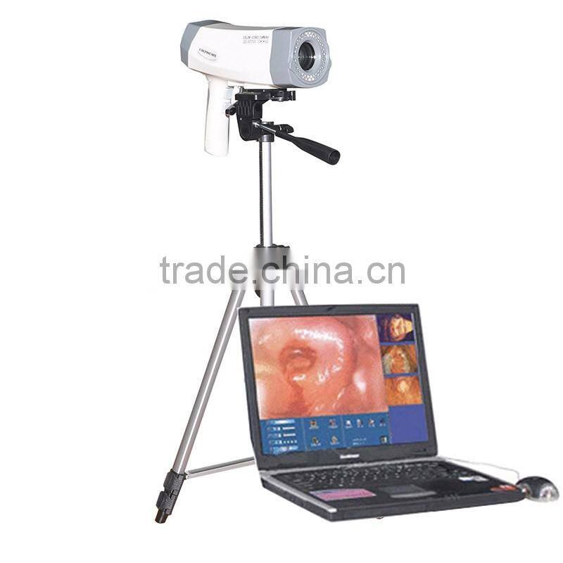 Factory price 2016 hot sale Electronic portable digital video colposcope for gynecology