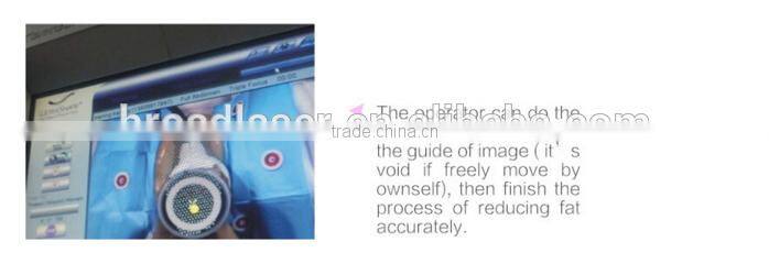 beauty slimming machine ultrashape 2015