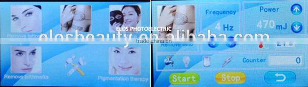 2016 Strong Energy nd:yag laser machine for tattoo removal