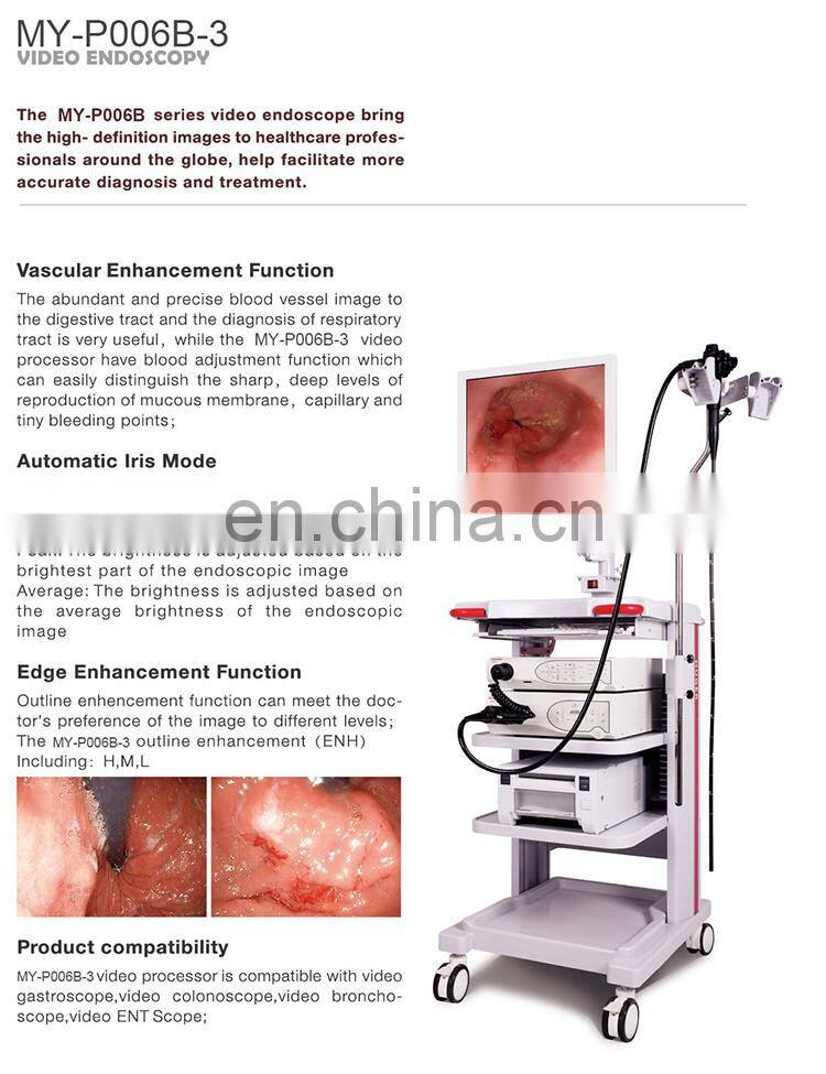 MY-P006B Medical HD Endoscope System with Video Gastroscope and Video Colonoscope