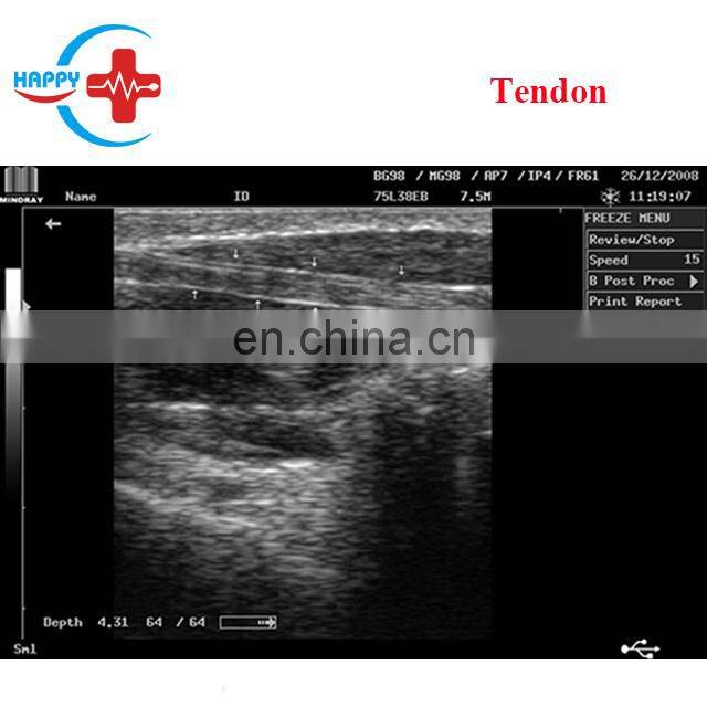 Original Mindray DP-2200PLUS mindray portable ultrasound machine system with competitive price