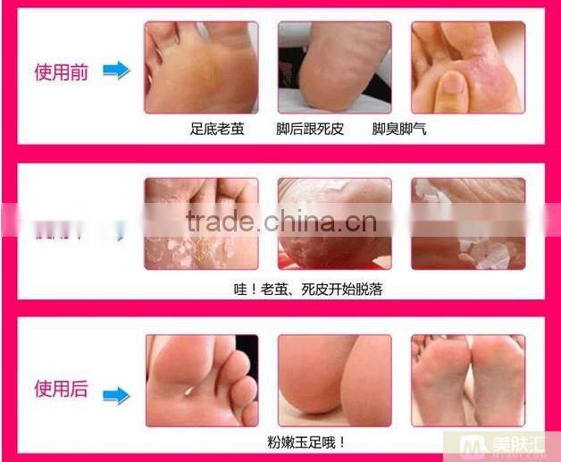 Beauty peeling foot mask