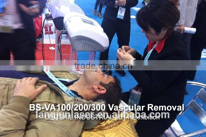 Beautiful Professional Cure Telangiectasia Treatment Vein Removal Equipment