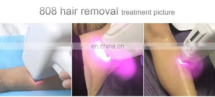 High quality with low cost permanent hair removal machine 755nm 808nm 1064nm diode laser for hair removal