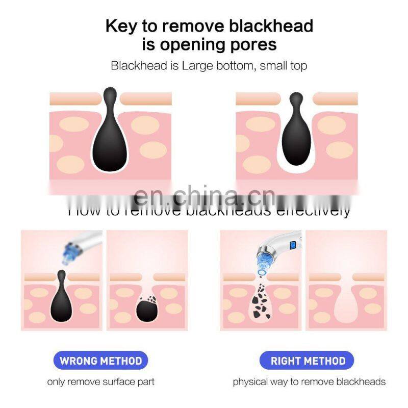 2018 China supplier vacuum pore nose blackhead sucker