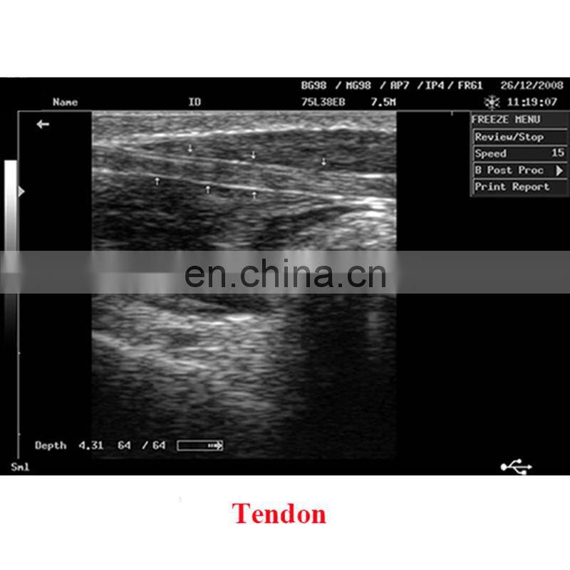 Hot Sales Original Mindray DP-2200PLUS Portable Full digital ultrasound machine /mindary ultrasound