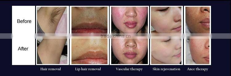 Professional ipl opt shr / RF / Laser ipl hair removal machine