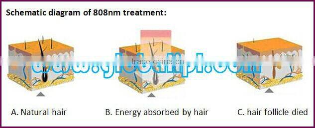 Powerful fast skin care oem no no hair removal laser