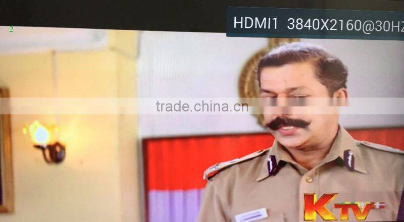 arabic iptv account MAG 250 MAG 254 home strong iptv Amlogic S812 Quad Core Google android tv box kodi Full HD Media Player