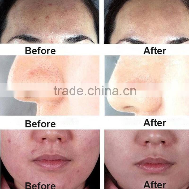 Popular beauty design rechargeable electronic skin cleansing machine sonic vibration brush