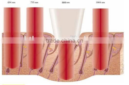 CE/GOST-P approved Wireless Diode laser system Dental Laser Equipment / Diode Laser 808nm hair removal