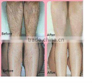 IPL beauty machine for breast lifting China best