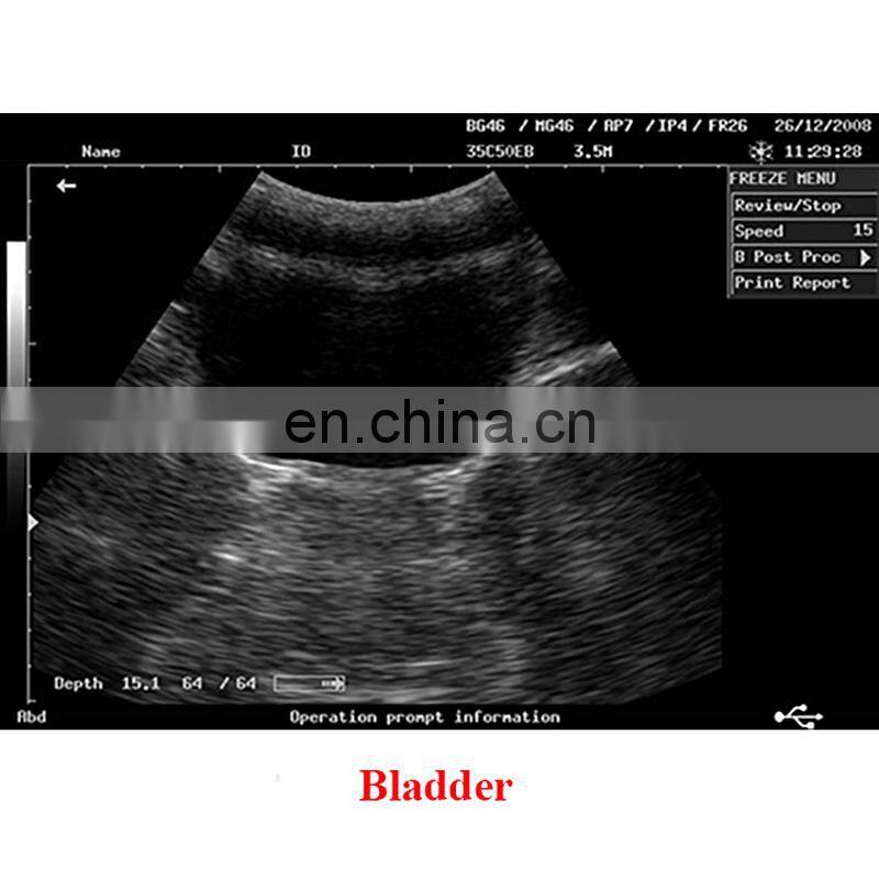 Hot Sales Original Mindray DP-2200PLUS Portable Full digital ultrasound machine /mindary ultrasound