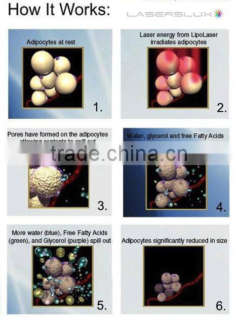 Beir Factory lipolaser slimming /mini lipo cold laser/ 36 diodes lipolaser weight loss pad