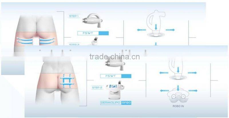 Fast Effective Best Cellulite Removal Slimming Radio Frequency Vacuum Roller Machine