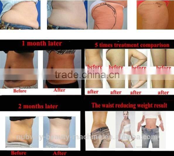 Weight loss fat melting machine cavitation slimming device home use