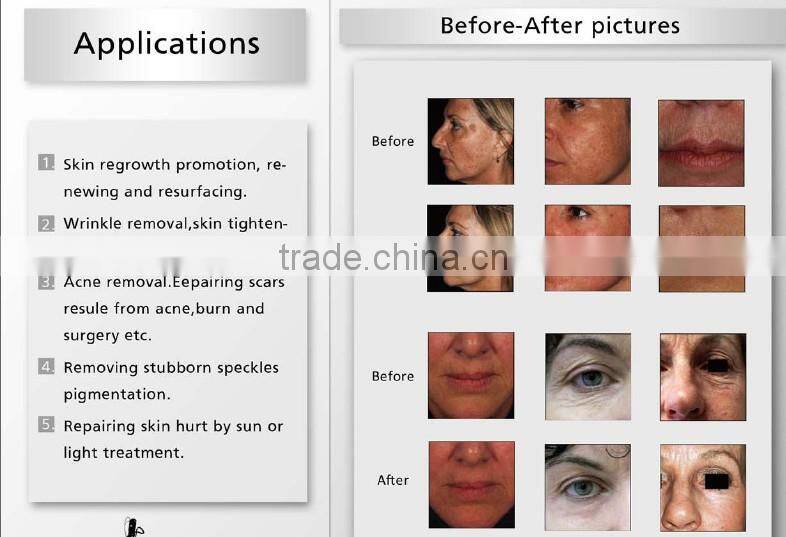 CO2 Fractional laser laser resurfacing machine