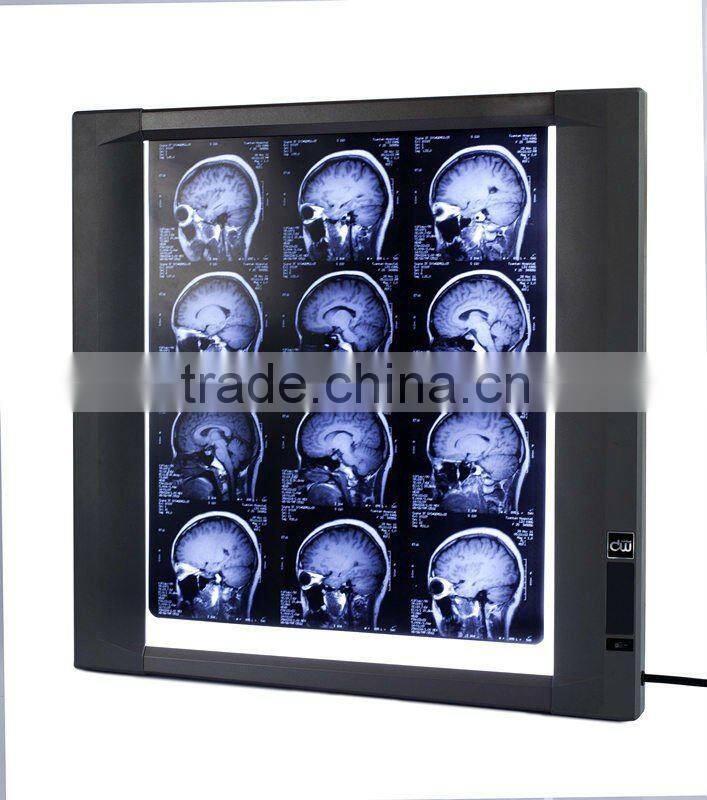 Digital x ray film reader