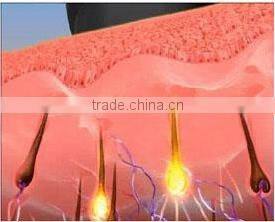 Hot Promotion!!!!!! Spa shr ipl hair removal machine shr hairy removal opt