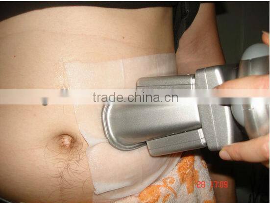 Chinese supplier wholesales 4 handles cryolipolysis machine