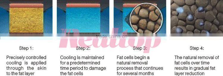 Newest model cryo-lipolysis cryotherapy freezing fat removal cellulite machine!weight loss lipo cryo machine on sale promotion