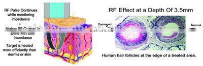 stationary skin care wrinkle removal rf machine/bi-polar rf machine