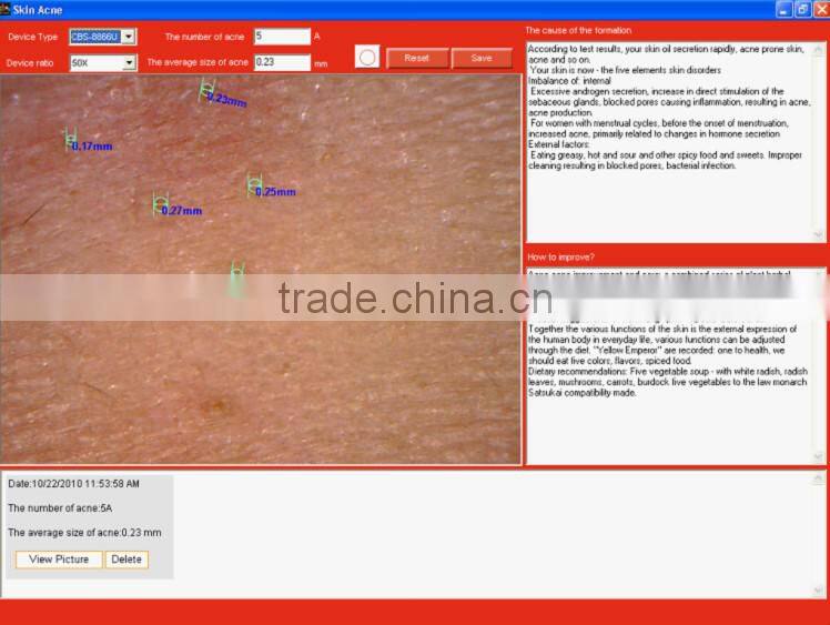 High precision digital skin moisture monitor UV skin analyzer with CE