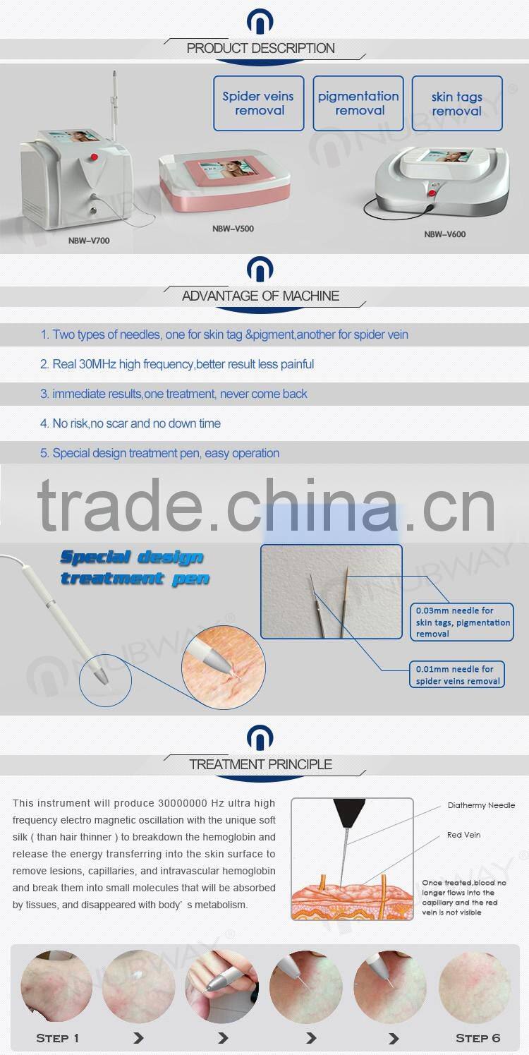 Professional RBS vein wave machine facial and leg rf spider vein removal machine