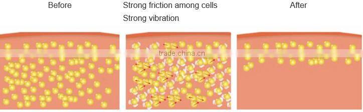 5 in 1 lost weight explosive speed grease cavitation slimming system