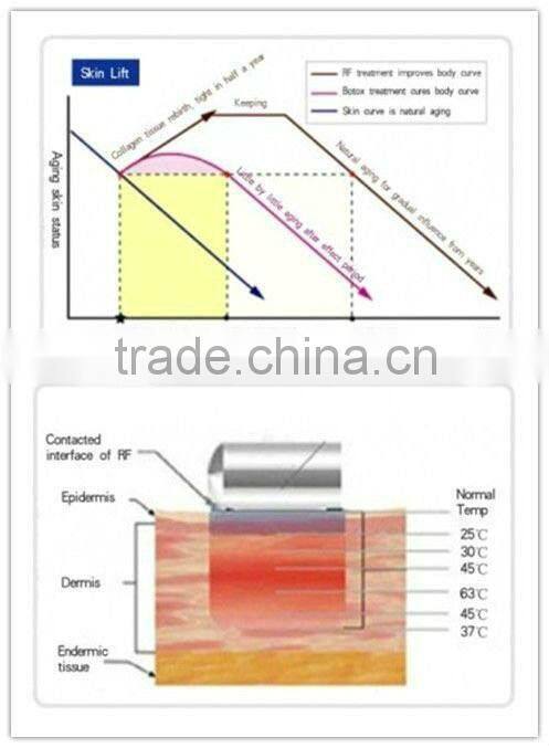 Hot sale cool shaping cavitation slimming machine