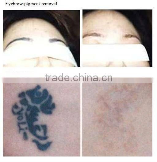 Hot selling Black baby laser cleaning machine