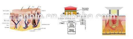 Apolomed beauty equipment skin rejuvenation hair removal shr ipl machine