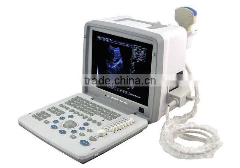Veterinary Ultrasound Scanner ultrasound machine Vet convex rectal probe for animal use RUS-9000BV