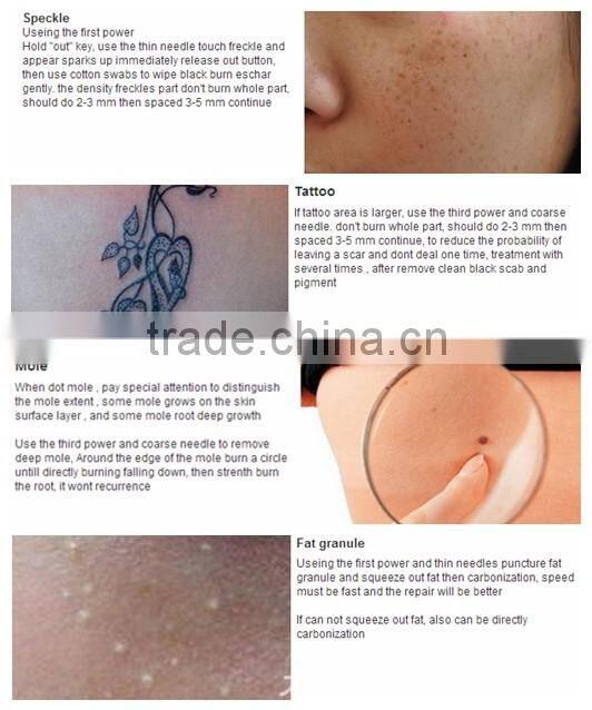 Portable Mini Laser Spot Removal Pen Laser plasma spots removal pen Removal Scars Beauty dark spot mole removal machine