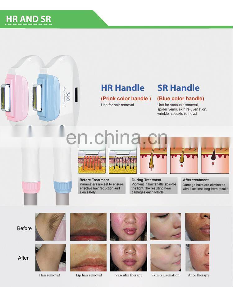 Newest model shr opt e-light ipl hair removal machine pain free opt SHR laser rf