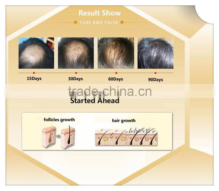 2years/3years shelf life Andrea hair regrowth hair care natural hair essence oil hair growth agent hair loss treatent