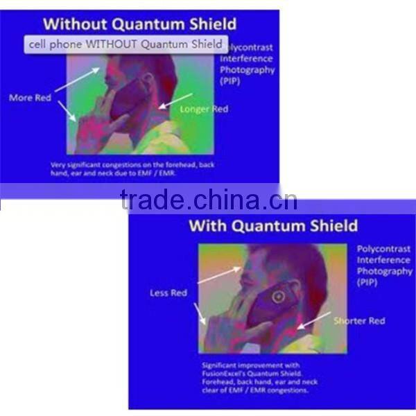 Healthcare Bio nano energy saving sticker with reasonable price