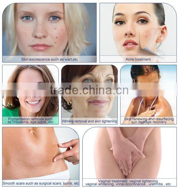 Merry christmas biggest discount! GGLT 30w CO2 Fractional laser vaginal rejuvenation machine