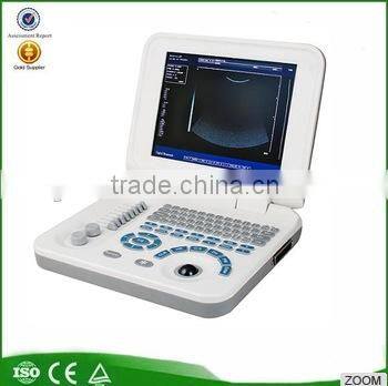portable ultrasound scanner ultrasound machine with low price