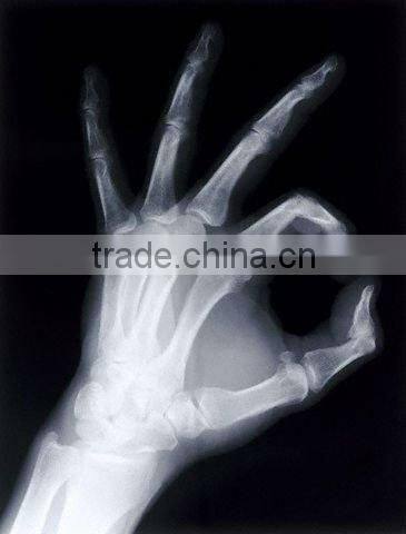 Manufacturer of films,medical dry imaging film with CE,konida x ray film,fit for with fuji and agfa printers