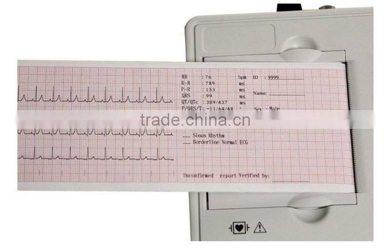 Cheap price 3 channel Resting ECG Machine Electrocardiograph electrocardiogram EKG factory